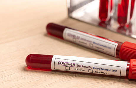COVID-19 Blood Test