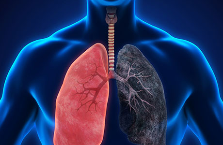 COPD and Quit Smoking